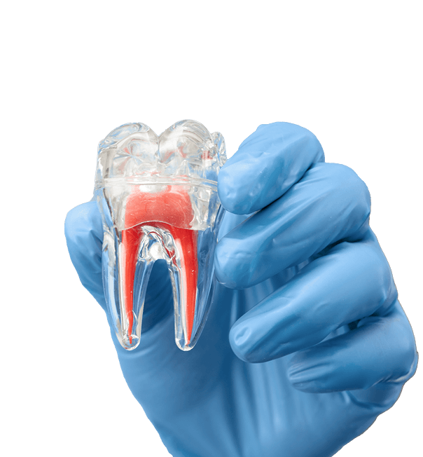 endodontinis gydymas