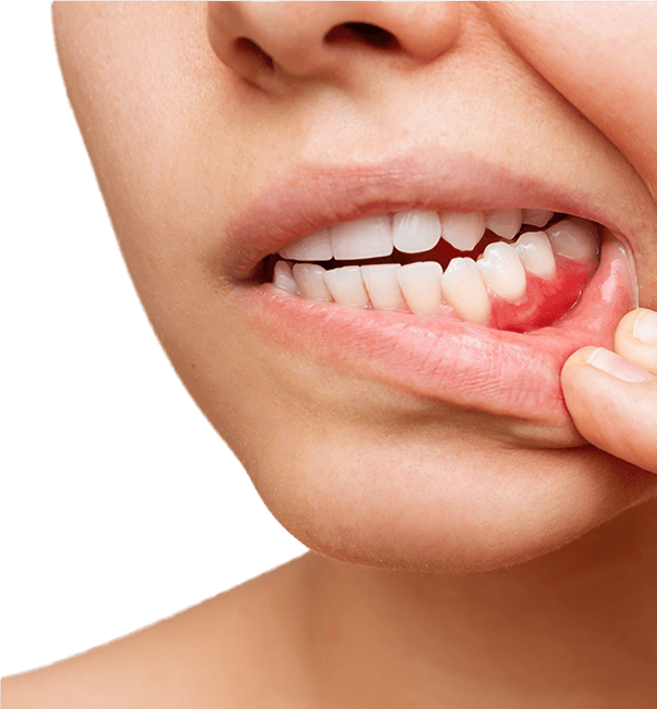 periodontologija